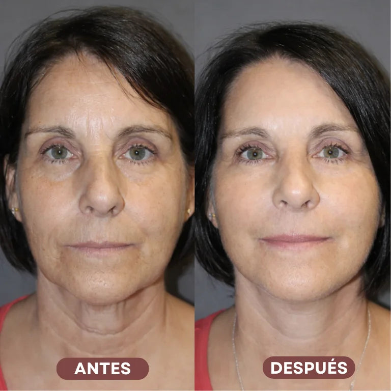 PROMO 2x1 | SERUM ANTIOXIDANTE : REDUCE ARRUGAS Y LINEAS DE EXPRESIÓN