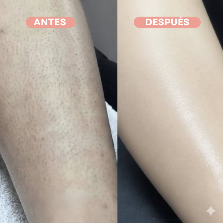 PROMO 2x1 | DEPILADORA FACIAL 2 EN 1 + DEPILADORA CORPORAL DE REGALO