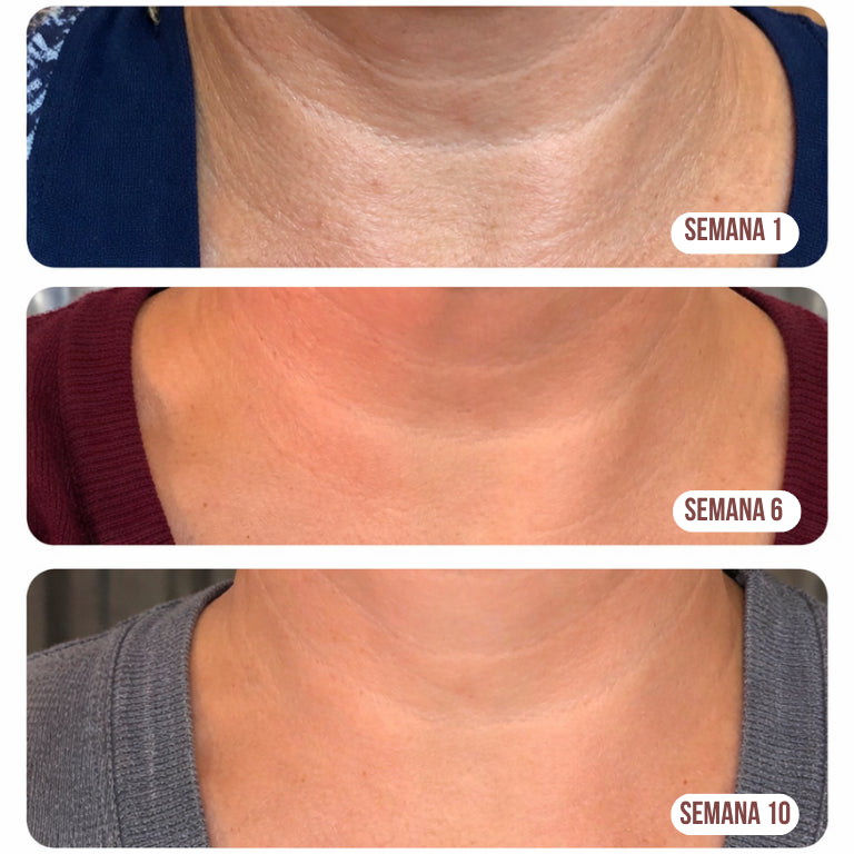 PROMO 2x1 | TRATAMIENTO REAFIRMANTE PARA CUELLO Y BUSTO