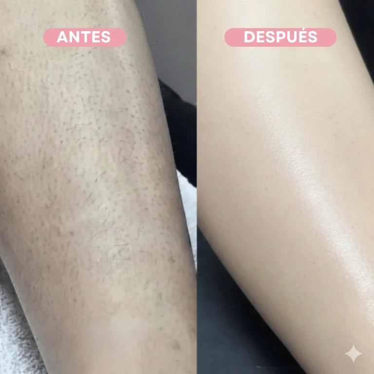 PROMO 2x1 | DEPILADORA FACIAL 2 EN 1 + DEPILADORA CORPORAL DE REGALO